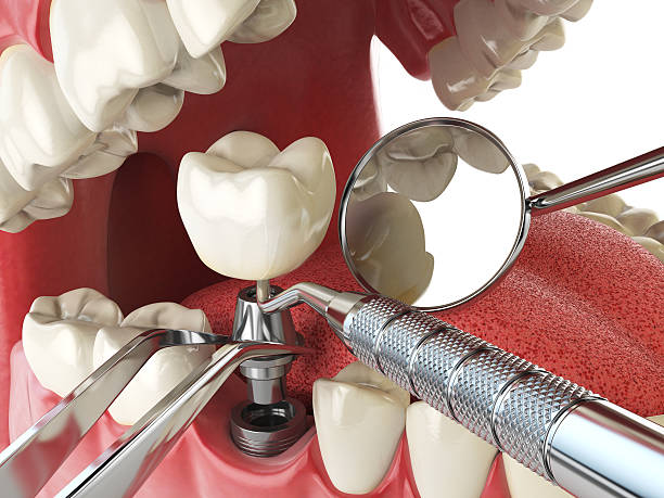 Best Pediatric Emergency Dentist in Osburn, ID