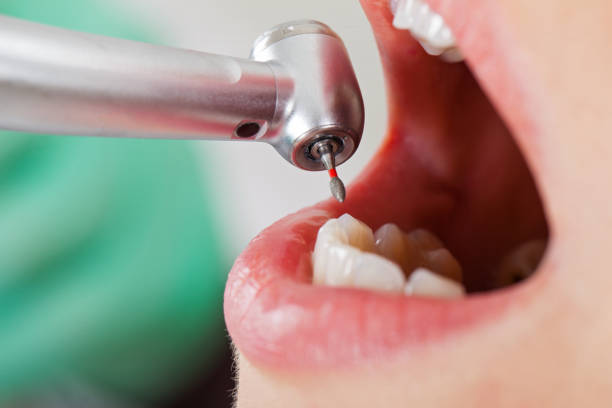 Best Pediatric Emergency Dentist in Osburn, ID